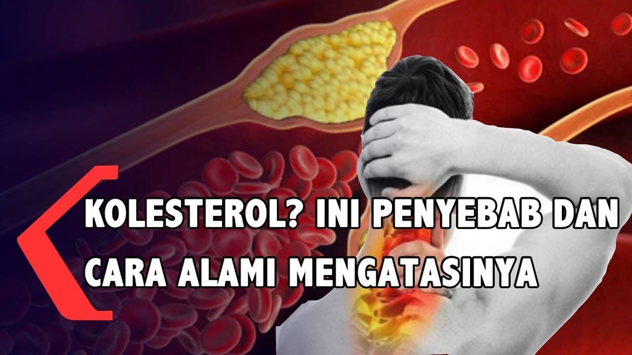 Penyebab Kolesterol Tinggi dan Cara Menghilangkan Kolesterol