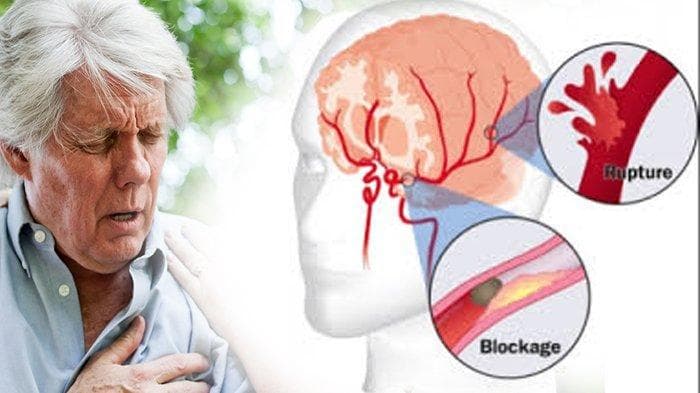 Cara Squalene Menjegah Penyakit Jantung Koroner